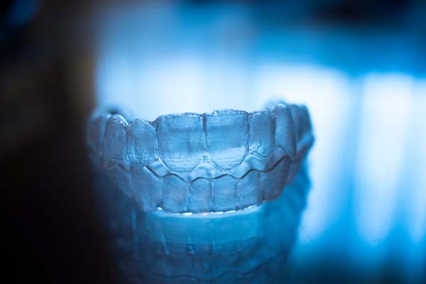 Consider Clear Braces For Straighter Teeth