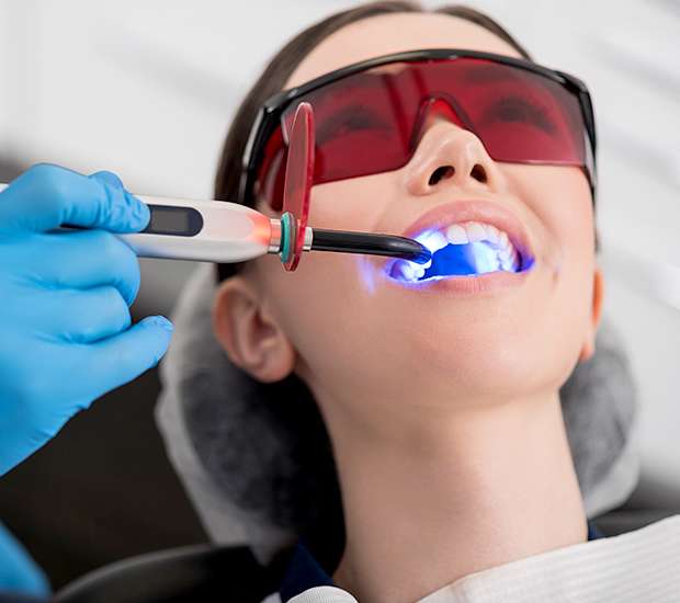 Greensboro Professional Teeth Whitening